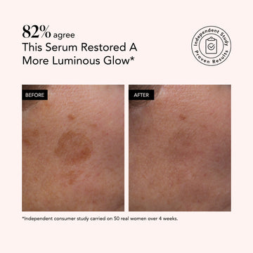 Side-by-side comparison shows reduced dark spots and more even skin tone after using Odacité Brightening Serum with Vitamin C & E + Hyaluronic Acid.