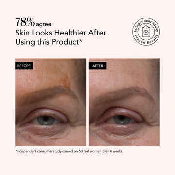 Close-up before and after images showing smoother skin after using Odacité Brightening Serum with Vitamin C, E, and Hyaluronic Acid.