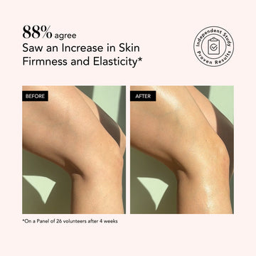 Side-by-side photos show knees appearing firmer and more elastic after using Odacité C-Glow Hydra-Firm Body Oil.