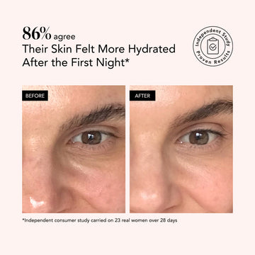 Two close-ups comparing skin before and after Odacite Crème de la Nuit show visibly smoother, more even texture.