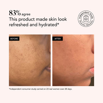 Side-by-side close-up of skin before and after Odacité Green Smoothie Ultra-Quenching Crème, showing smoother, more hydrated skin.