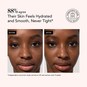 Side-by-side close-up of skin before and after using Odacité Jojoba Pearls + White & Rooibos Tea Daily Hydra-Exfoliant.