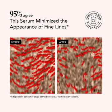 Side-by-side faces before and after Odacité Renewing Serum use; reduced red fine lines seen after Retinol + Hyaluronic Acid.