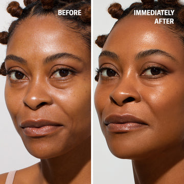 Woman’s face shown before and after using Odacité Anti-aging Dream Duo SPF 50 + Retinol; skin appears smoother and more radiant.